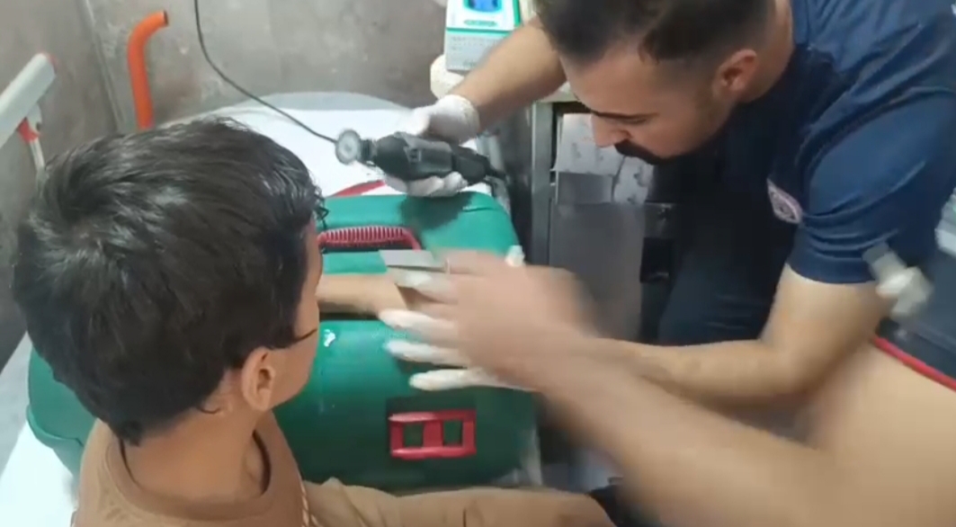 Şanlıurfa’da 10 yaşındaki Davut’un parmağına sıkışan rondelayı itfaiye çıkardı