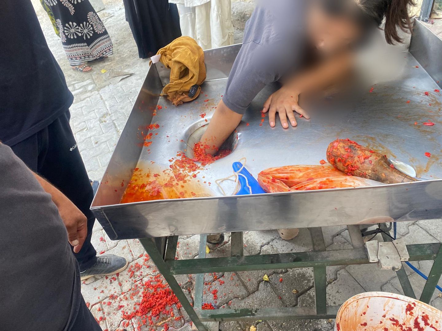 Şanlıurfa’da elini salça makinesine kaptıran genç kızı itfaiye kurtardı